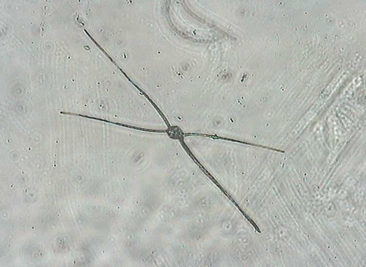 Dictyocha speculum